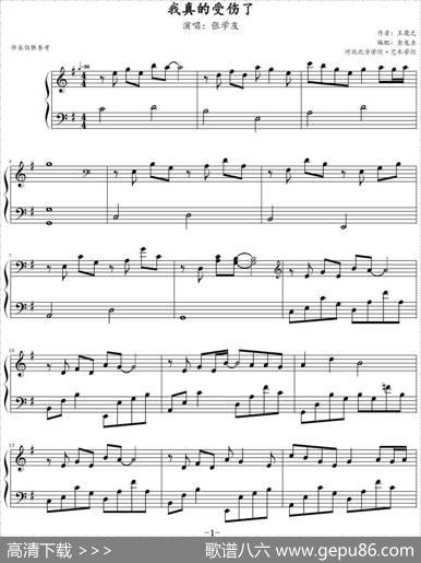 我真的受伤了|王菀之作曲金龙鱼编配